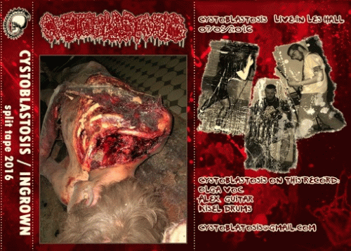 Cystoblastosis : Cystoblastosis - Ingrown